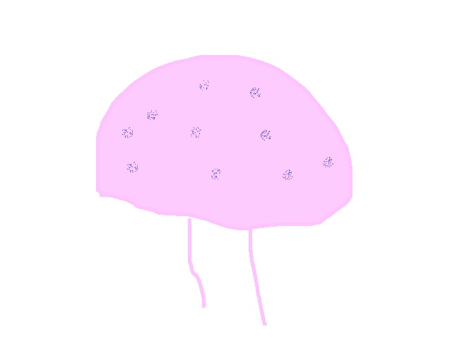 Jellyfish or Pig or Pink Christmas Tree?